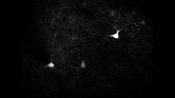 Two-photon imaging shows neurons firing in a mouse's brain.  
